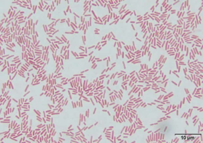 һ����ϸ�����ܻ�ٳ���������Ⱦ������Һ���Σ�ջ���