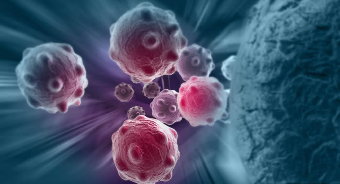 俄罗斯国立核能研究大学专家介绍最为高效安全的癌症治疗方法:光动力疗法