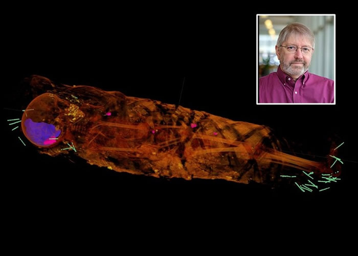 斯托克(小图)以X光电脑扫描技术研究木乃伊。