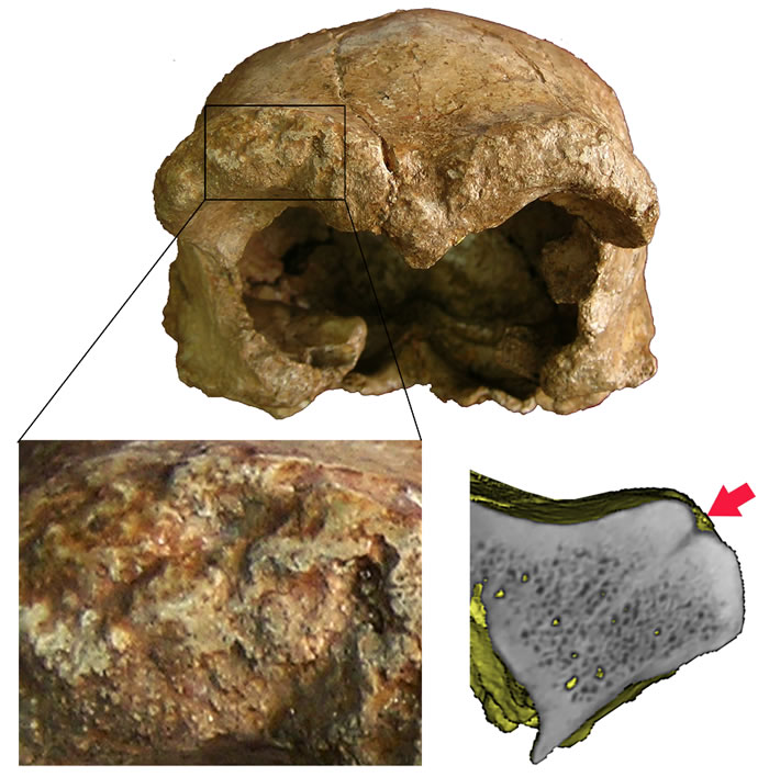 和县直立人眶上圆枕部环境侵蚀痕迹(吴秀杰供图)