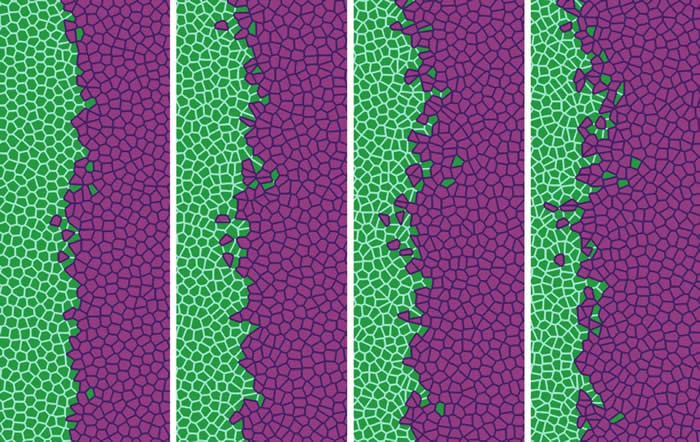 该图像显示癌细胞(紫红色)如何逐渐置换健康细胞(绿色)(图片来源:UC3M/UCM)