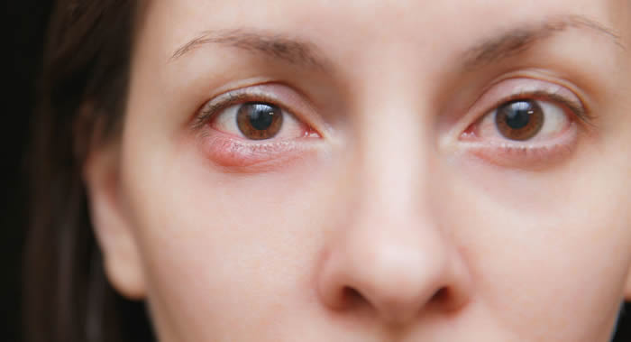 眼科医生Rui Hiramatsu:每天只花三分钟使用Gabor点状图纸进行锻炼就能改善视力