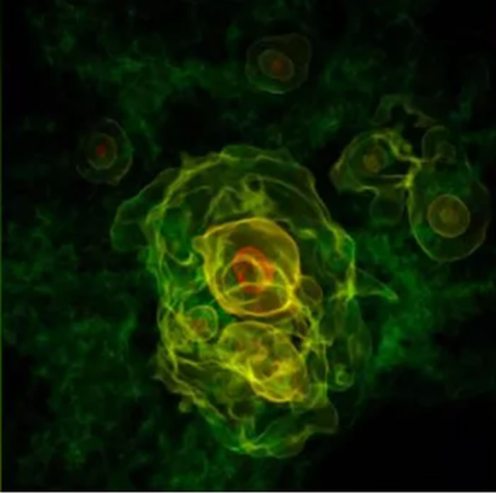 图中显示的是大爆炸之后宇宙膨胀阶段出现的稠密膨胀团,这就是宇宙诞生之初的模样