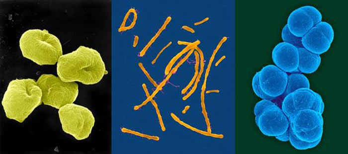 科学家正在研究嗜酸热硫化叶菌(图左)、富盐菌(图中)、甲烷八叠球菌(图右)这样的古生菌如何生长和分裂的,从而阐明复杂细胞的进化历程