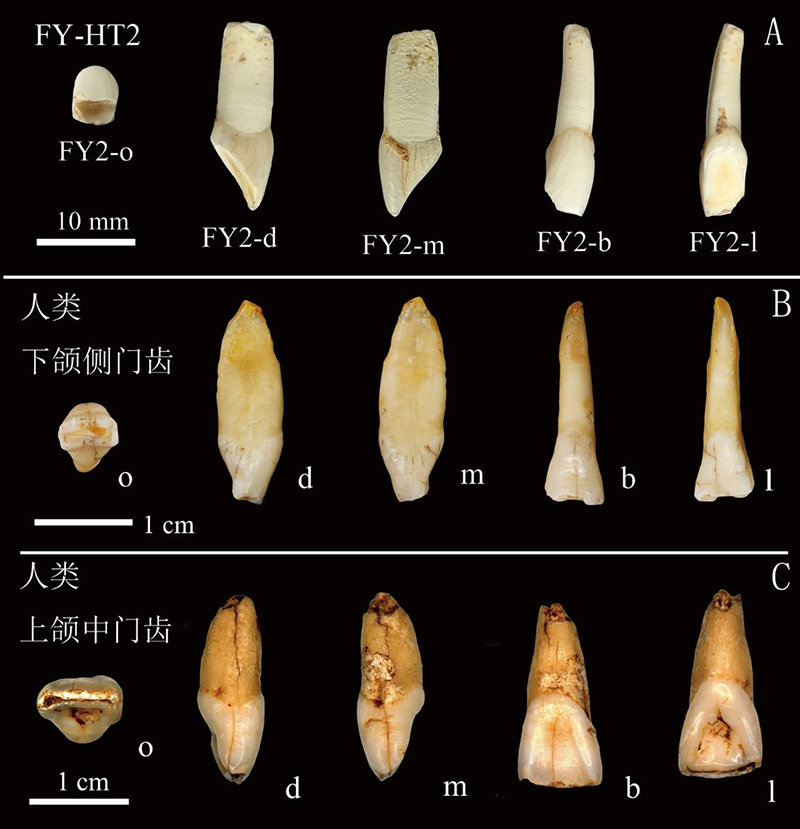孙雪峰等在福岩洞发现的牙齿同人类牙齿对比. (A)引自Sun et al. 2021;(B)道县2012年发现的人类下颌侧门齿;(C)黄龙洞2006发现的人类上