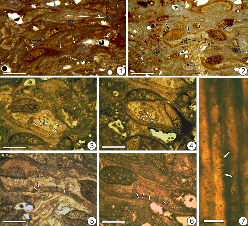 张氏绒紫萁(新种)叶柄基特征