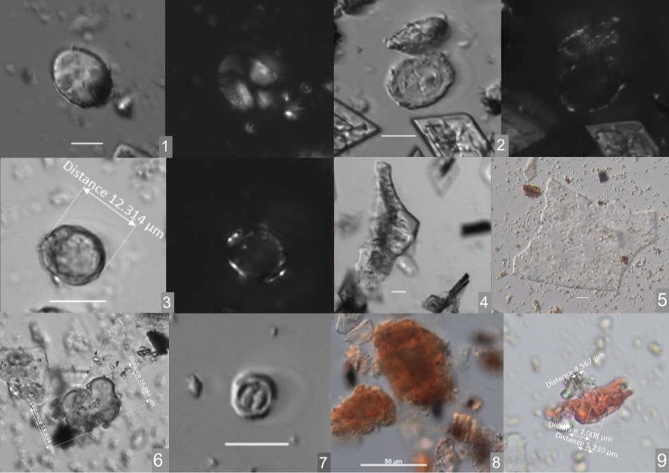 从仰韶村遗址小口尖底瓶样品中提取到的微体化石,包括淀粉粒、植硅体、霉菌和酵母等(拼版照片)。河南省文物考古研究院供图