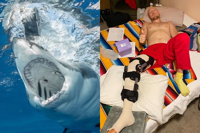 美国加州男子冲浪时被大白鲨咬住腿部 挥拳暴击鲨鱼脸部成功逃脱