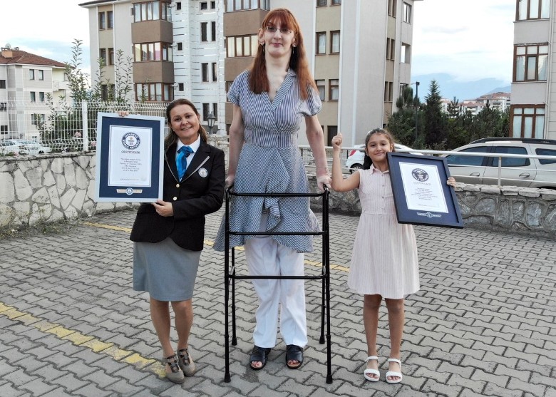 ������Ů��Rumeysa Gelgi��215.16���׵����߳�Ϊȫ�����Ů��