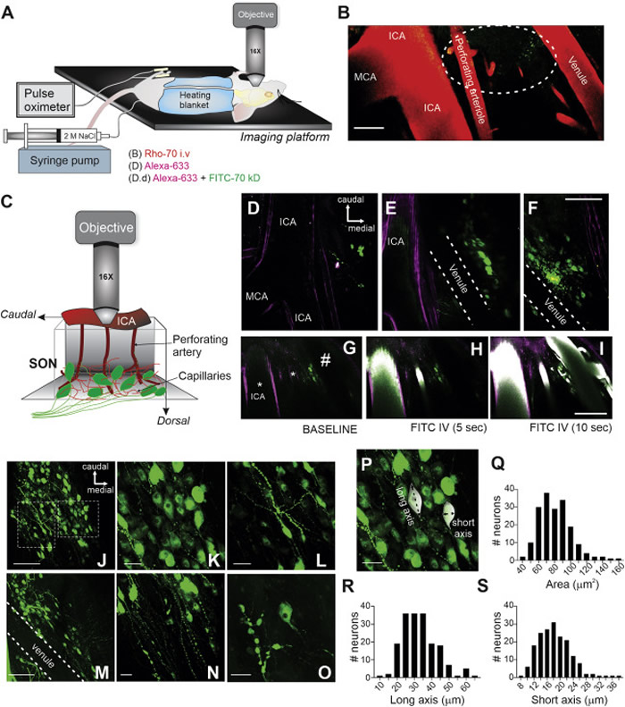 ���о��״η��֣���̫����Ӱ��Ĳ�����Ѫ�� �������ǵĴ���
