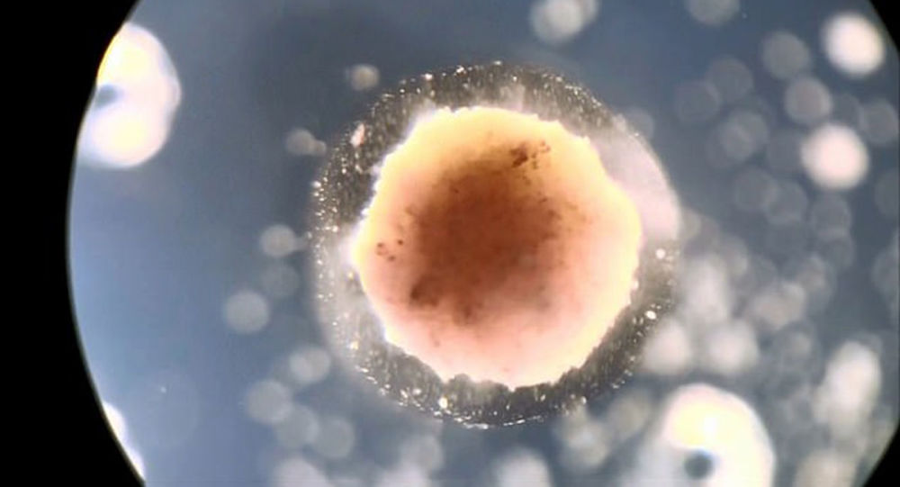 俄罗斯科学家开发出治疗前列腺癌的药物 有效率达到80%