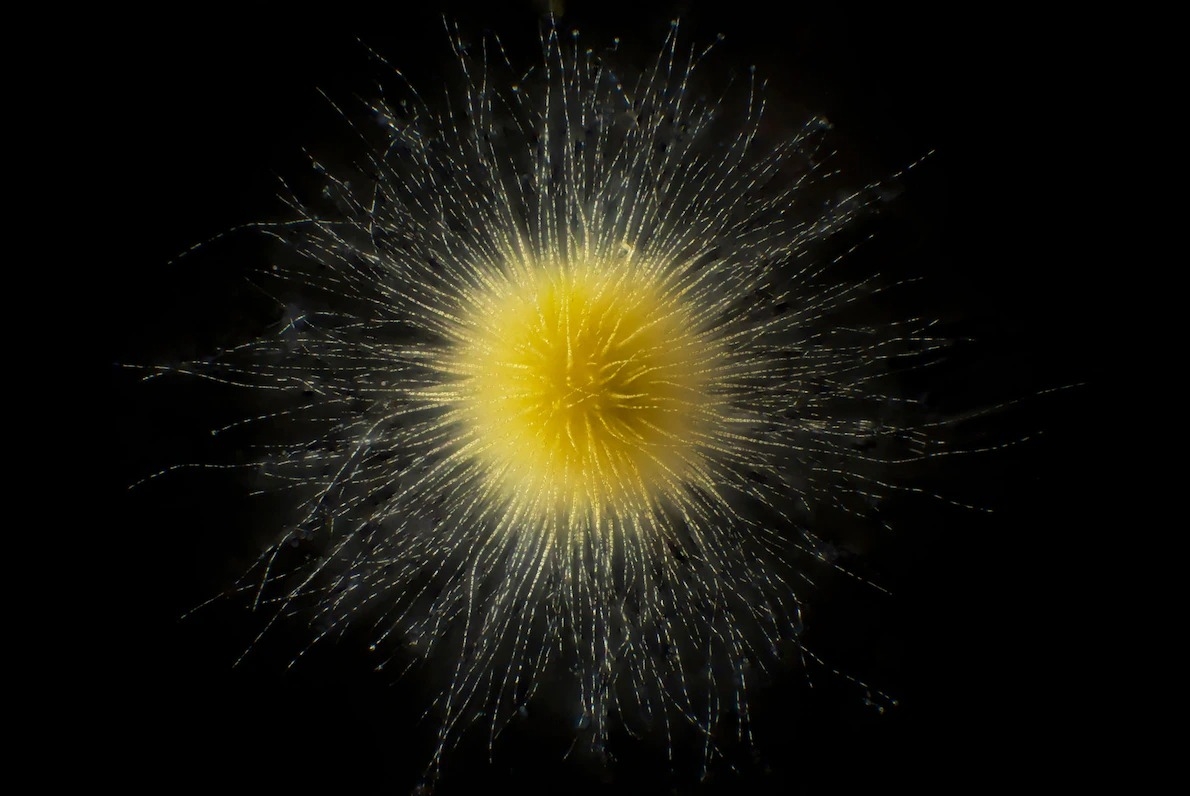 胶刺藻属(Gloeotrichia)的蓝绿菌(Cyanobacteria)对某些淡水生物来说是有毒的。 PHOTOGRAPH BY JAN VAN IJKEN