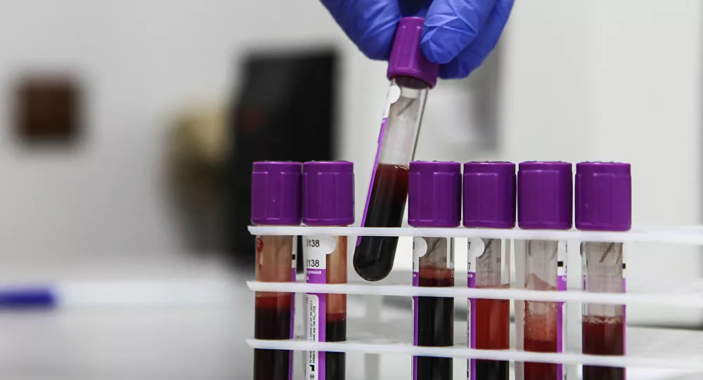科学家发现一种找到血液中癌细胞的有效方法