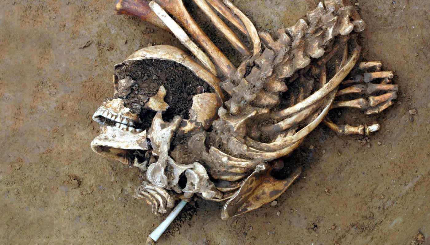 �Ŵ�DNA������ʾ��ͭʱ��Ӣ���Ĵ��ģ����