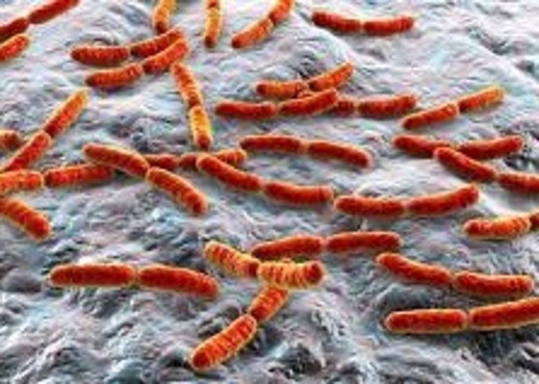 美国《科学》杂志：亚洲和北欧的新冠肺炎死亡率较低可能与肠道内细菌有关