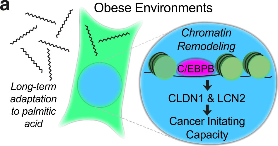 研究发现肥胖与癌症之间的关联所在