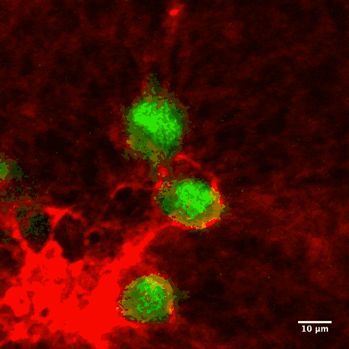 胶原蛋白I基质中的肿瘤细胞积极增殖