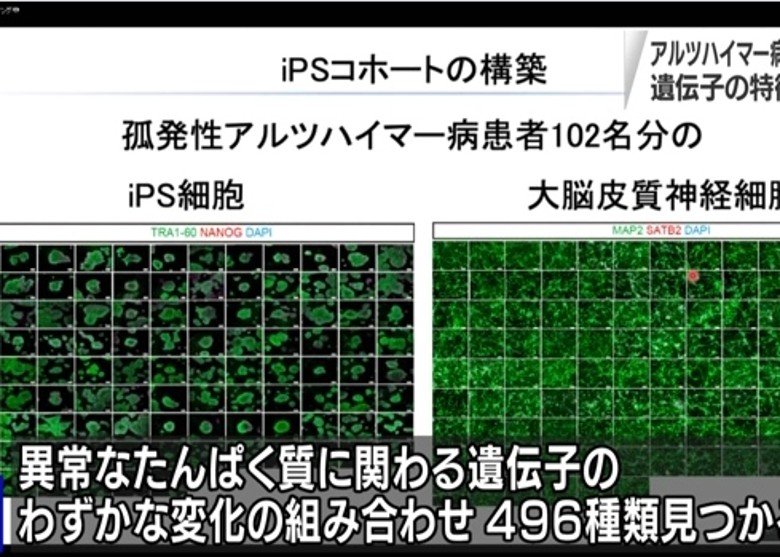 日本京都大学研究锁定阿兹海默症相关基因 助研治疗药物