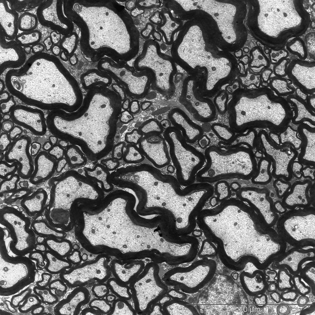 《美国国家科学院院刊》PNAS:研究人员证明牛奶如何引发多发性硬化症症状