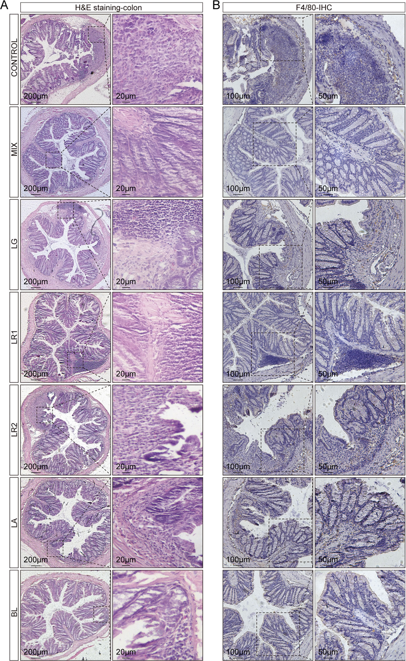 混合益生菌为辅助治疗炎症性肠病IBD提供新方法和新策略