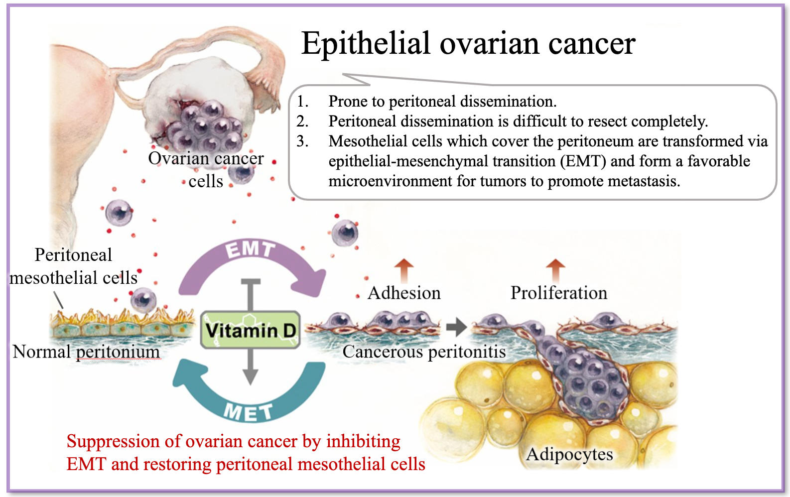 《Matrix Biology》杂志：维生素D能帮助抵御致命的卵巢癌