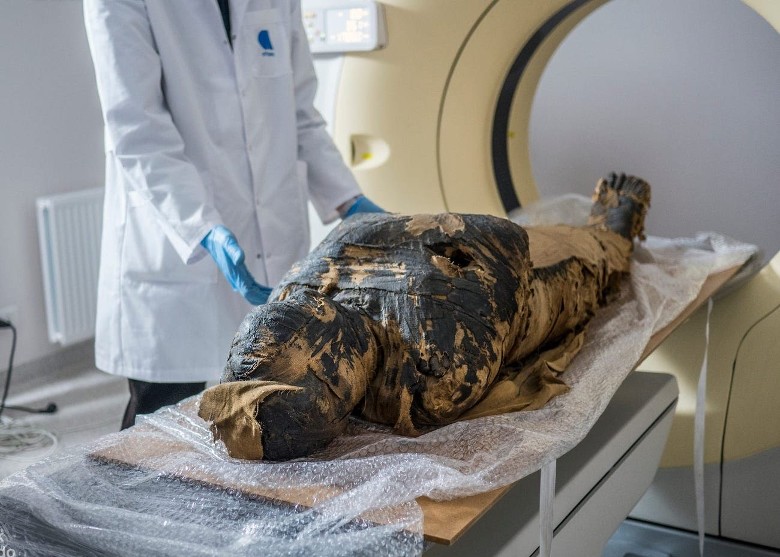 全球唯一怀有胎儿的古埃及木乃伊“神秘女士”或死于鼻咽癌