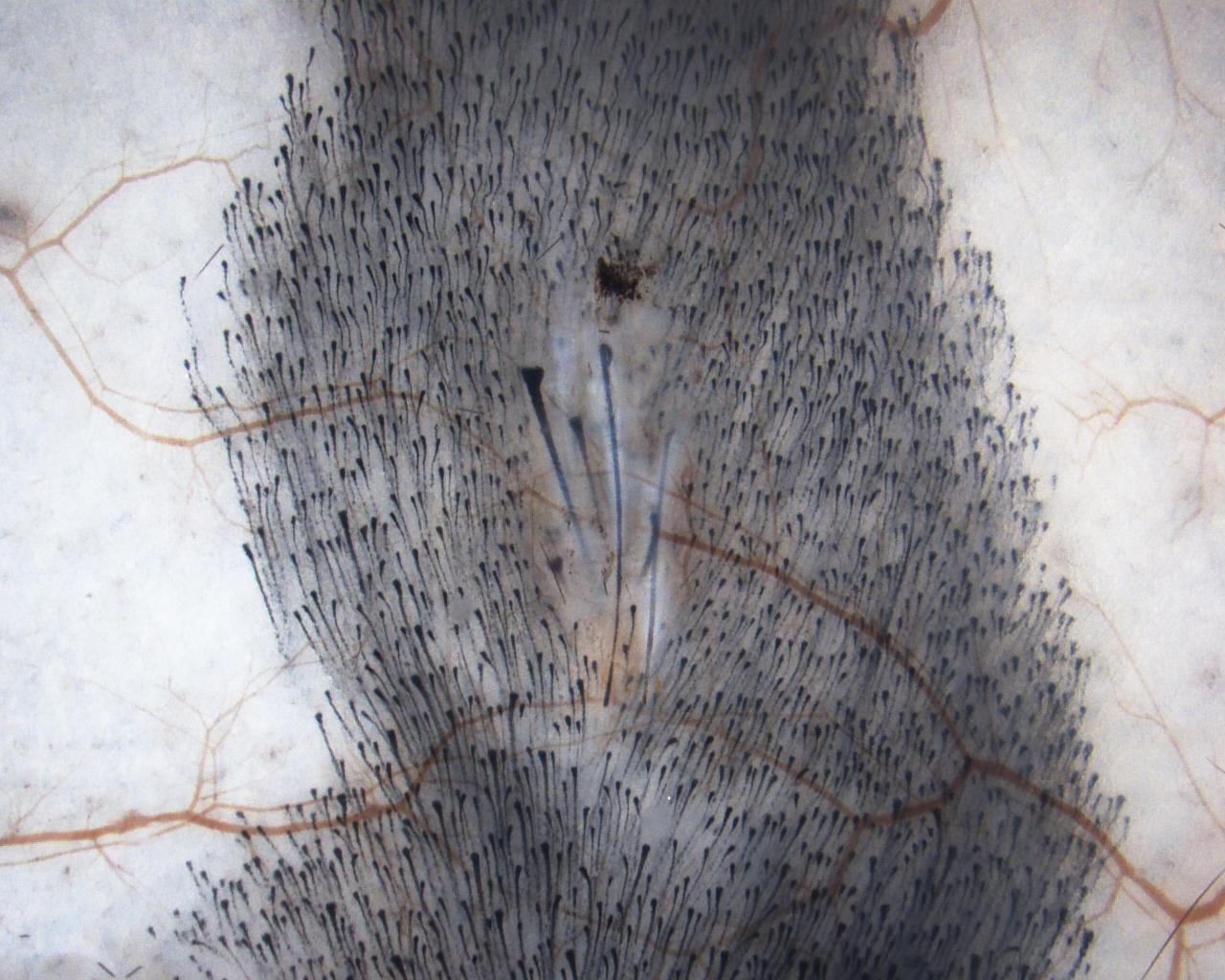 研究发现被称为SCUBE3的信号分子可能对治疗雄性激素性脱发症有效