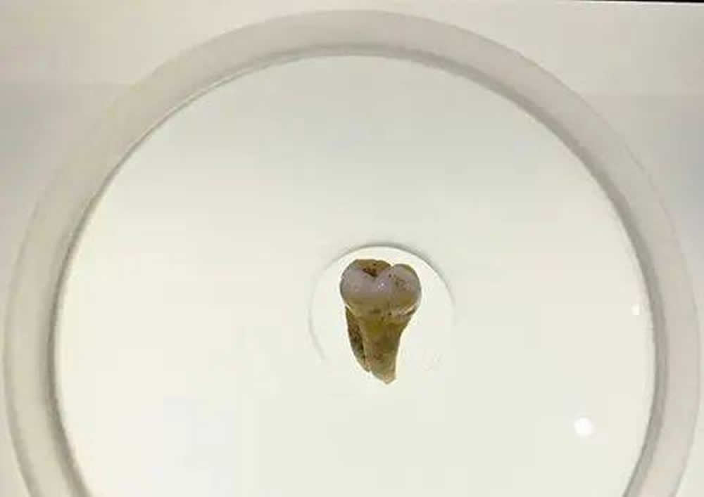 陕西省汉中市南郑疥疙洞旧石器时代遗址:为早期现代人演化提供依据