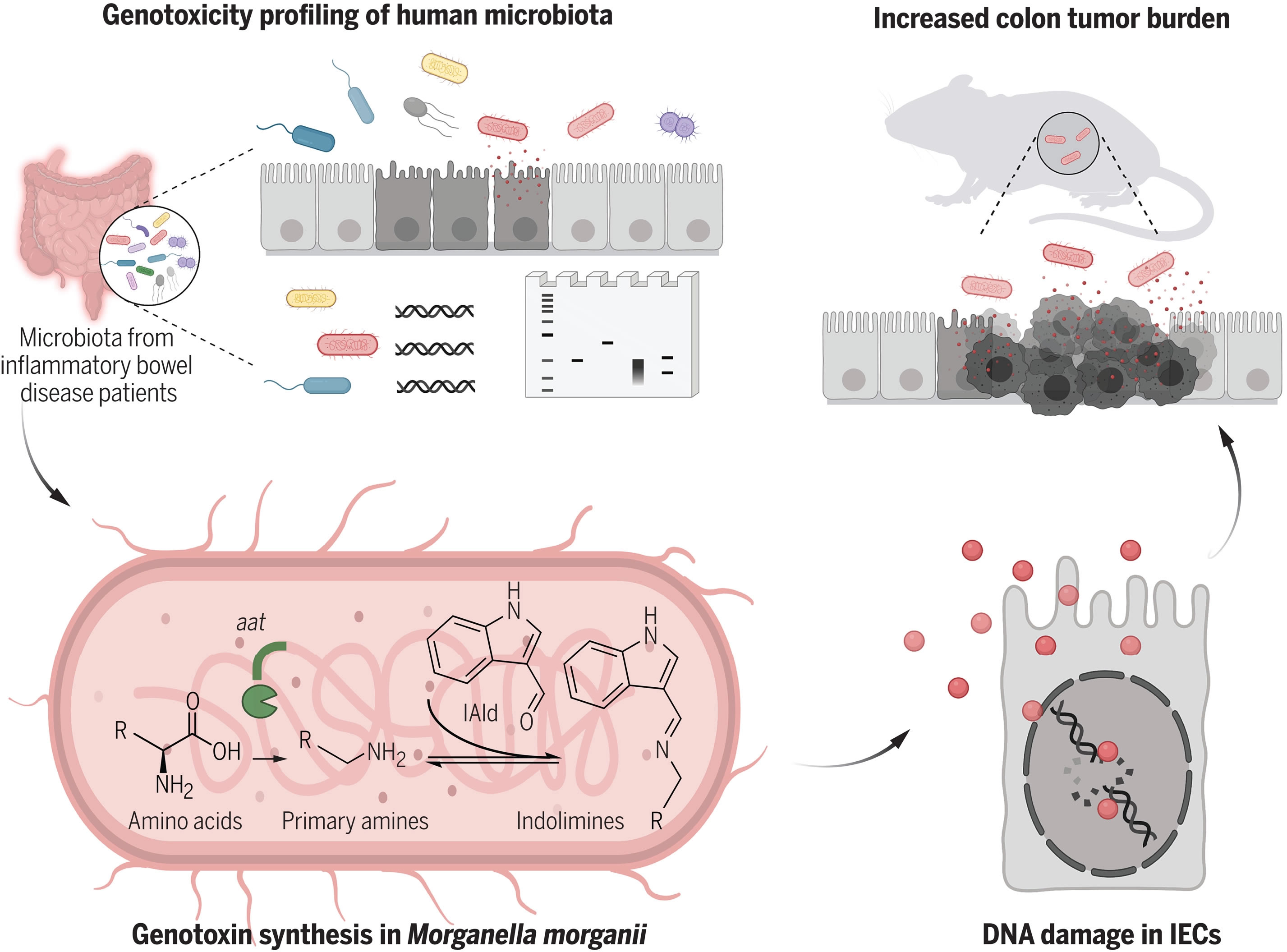 在炎症性肠病(IBD)患者中发现源自微生物的基因毒性代谢物
