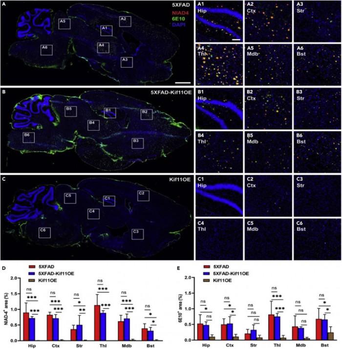 发现一种可以预防阿尔茨海默病的基因