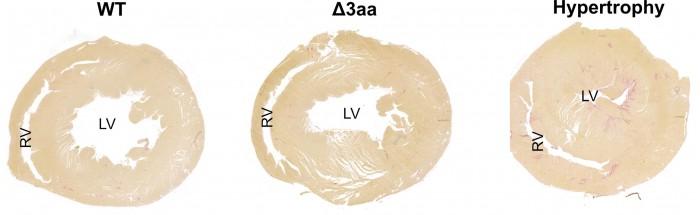 оֲָѪѹֵ߳Ļͻ𺦾