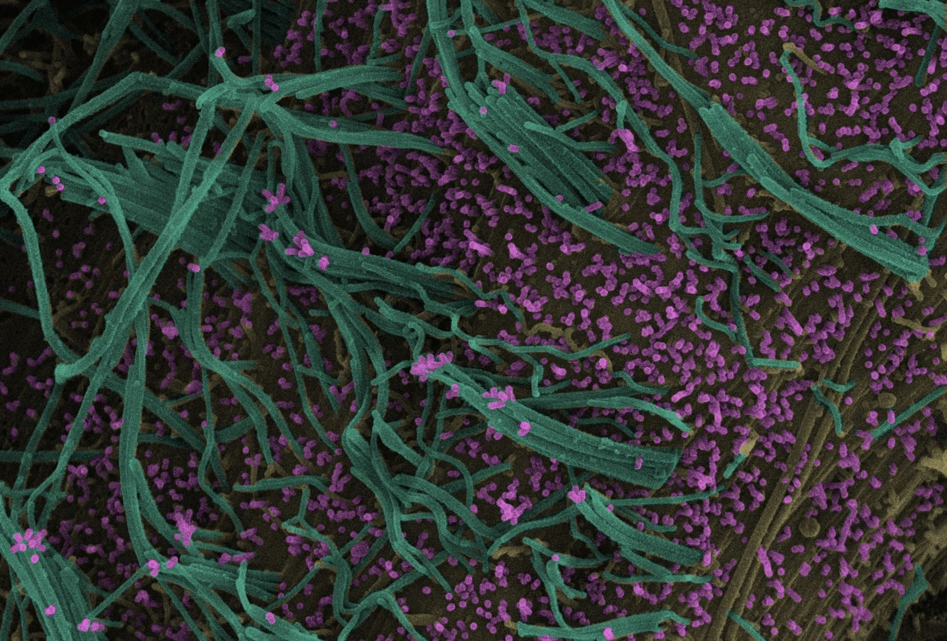 流感病毒和呼吸道融合病毒相结合会发生什么?