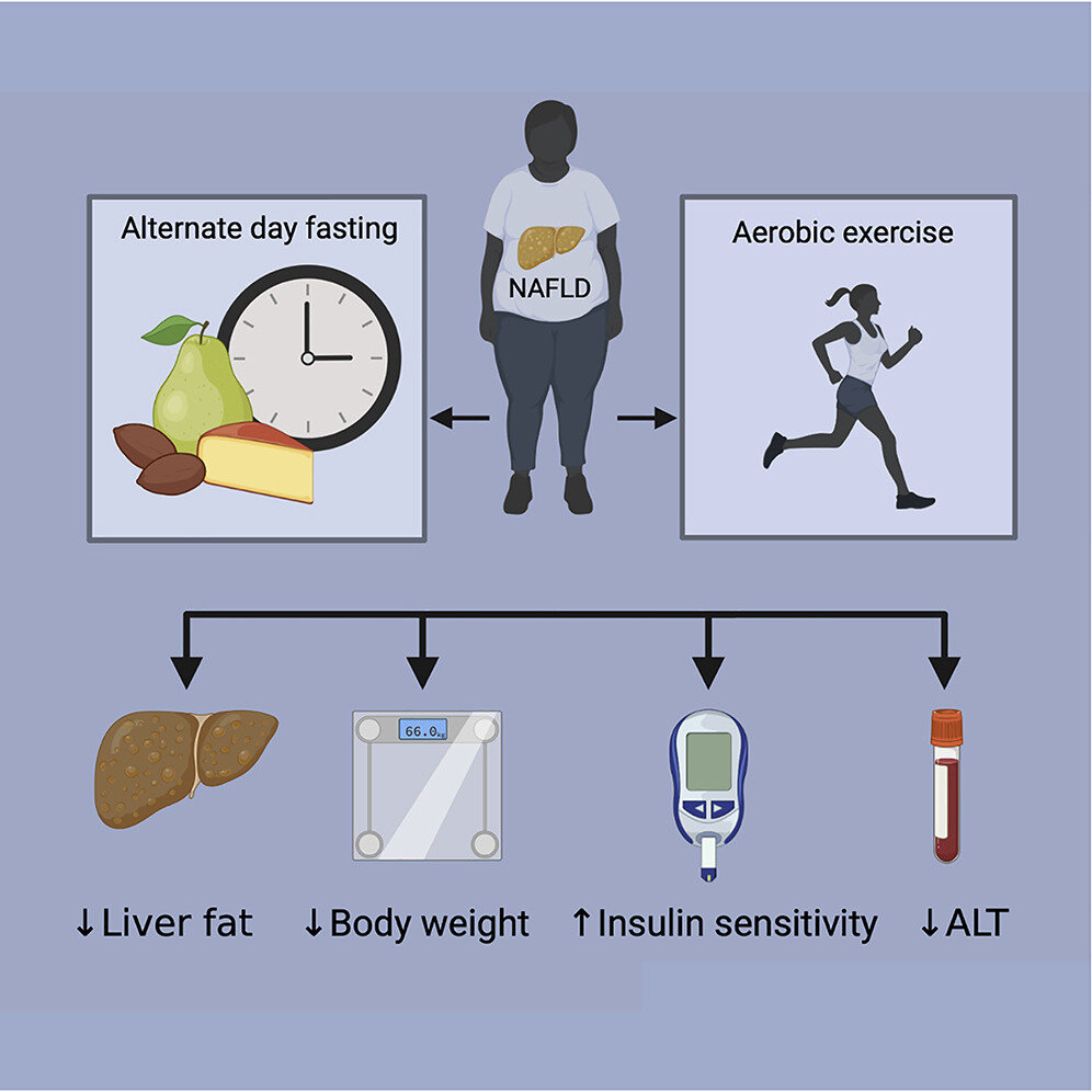 隔日禁食可能是脂肪肝患者的一个好选择