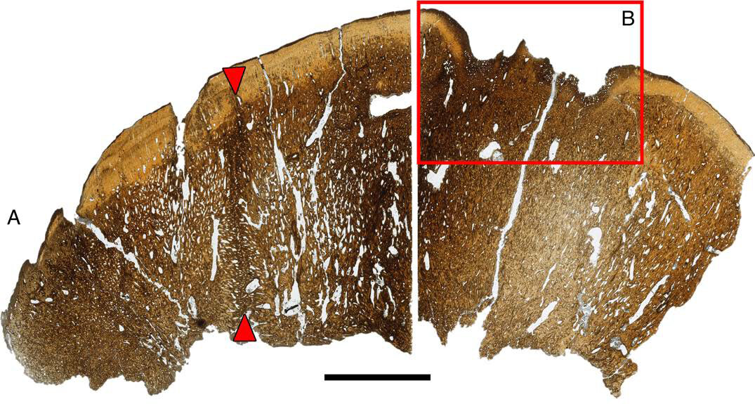 新描述的圆顶恐龙物种Platytholus clemensi可能戴着刚毛头饰