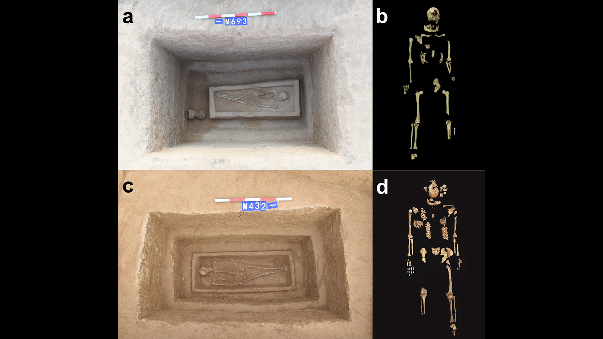 2500年前被砍下双腿的骨架可能是中国古代受到“残酷”惩罚的精英