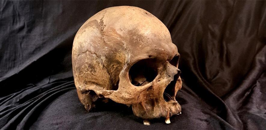 大规模DNA研究绘制了37000年的人类疾病史