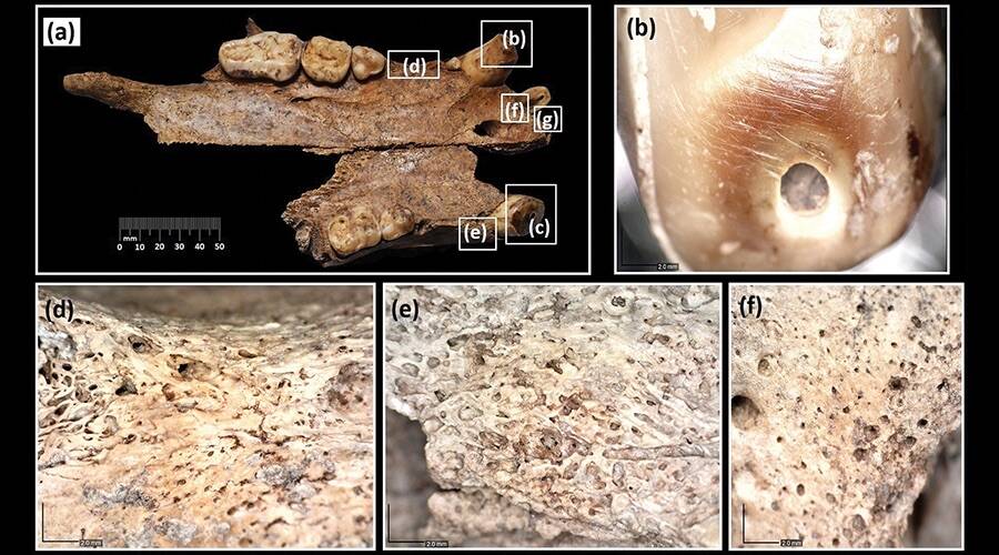 头骨提供了熊在罗马圆形剧场战斗的第一个直接证据