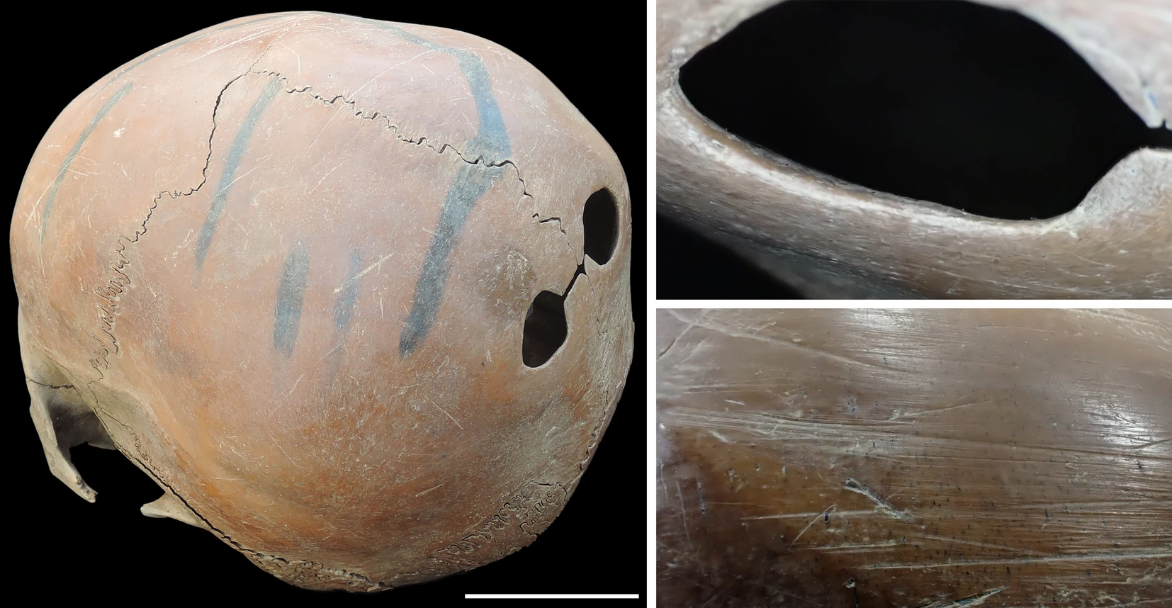 中国新石器时代文物展示了系统的人类骨骼改造