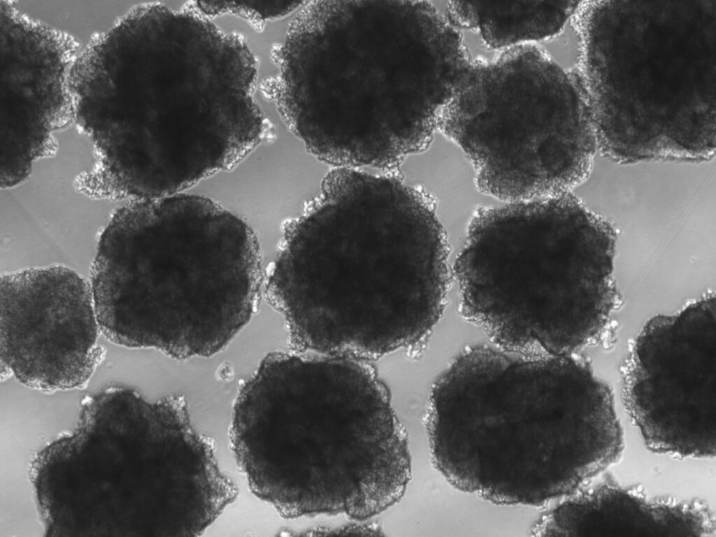 铅中毒有助于创造人类吗?令人震惊的研究表明,它可能塑造了我们的大脑和语言